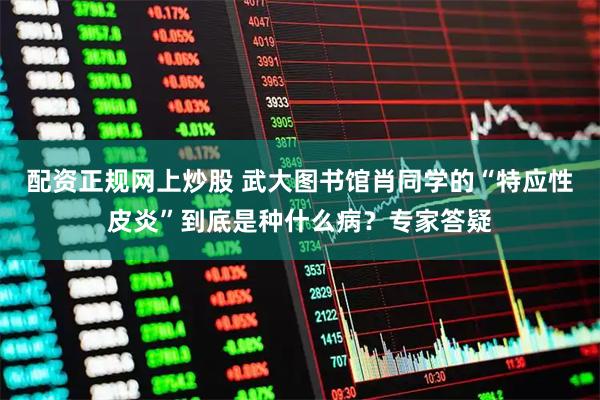 配资正规网上炒股 武大图书馆肖同学的“特应性皮炎”到底是种什么病？专家答疑